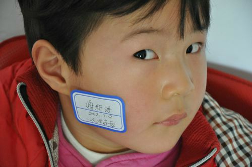 孕妈妈如何预防婴儿鲜红斑痣2